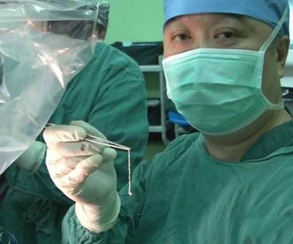 玉米男孩是什么病 虫卵洞原图恐怖:全身布满寄生虫