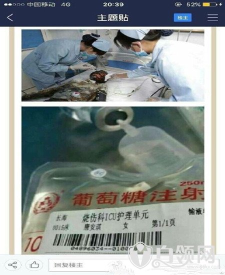 唐安琪现在怎么样了 snh48唐安琪烧伤事件始末经过