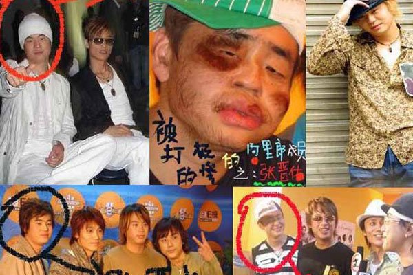 张晋佑被解救后的照片 欠巨款:阿里郎成员张晋佑被割舌头真的吗