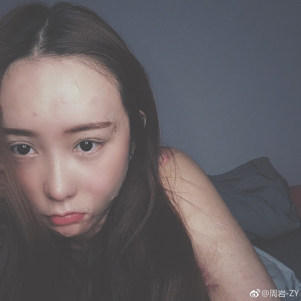 周岩现状恢复了新生活 毁容之前图片:周岩事件的详细起因经过