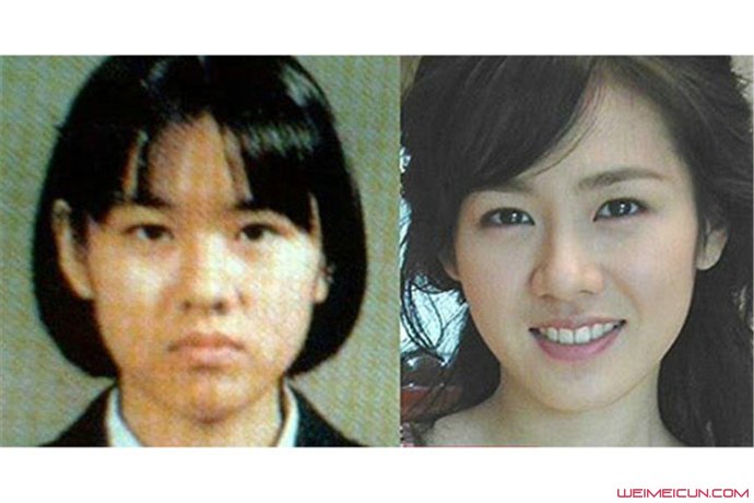 孙艺珍面相变了 整过容吗?孙艺珍的脸怎么了