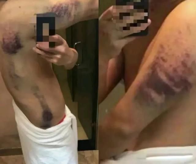 缅北开火车女孩一直哭视频事件 真实案例:缅北女孩20个人开火车56分钟