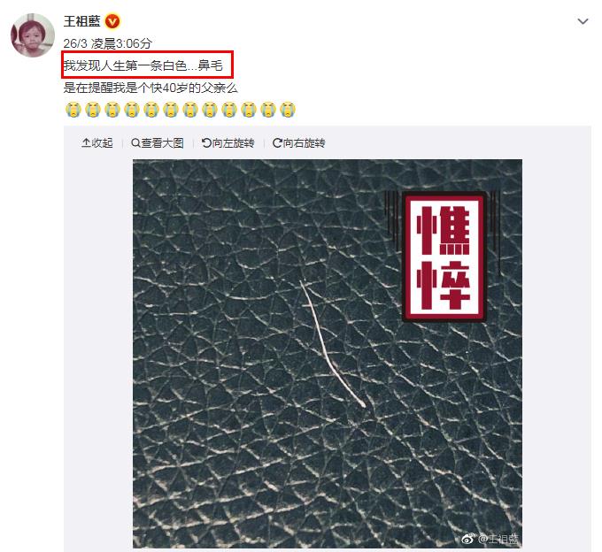 白鼻毛是怎么回事 民间说法:白鼻毛是什么预兆