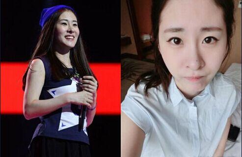 张碧晨整容呀对比前后 一大一小:张碧晨鼻子很奇怪整过容吗