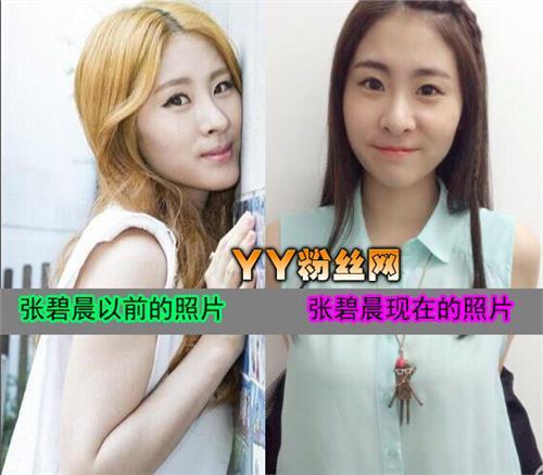张碧晨整容呀对比前后 一大一小:张碧晨鼻子很奇怪整过容吗