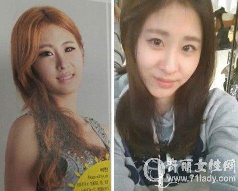 张碧晨整容呀对比前后 一大一小:张碧晨鼻子很奇怪整过容吗