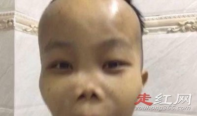 网红陈山怎么消失了 还活着吗?快手网红外星人陈山去哪了