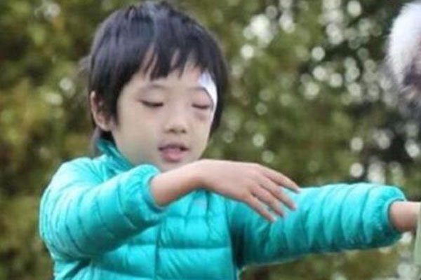 费曼眼睛的事最后怎么处理解决的 带伤录节目:眼角伤谁弄的