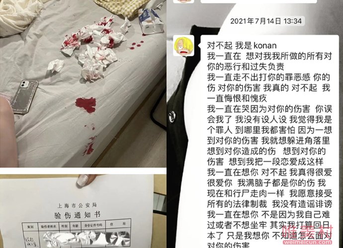 非正金子浩拓是个怎样的人 是个大男子主义的家暴软饭男