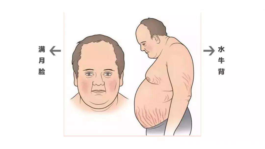 ��������ʲô��˼ �����ˣ���������ʲôԭ����ɵ�