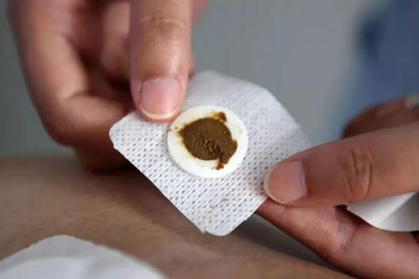 三伏贴贴敷部位图 一般都是贴在脖子后面
