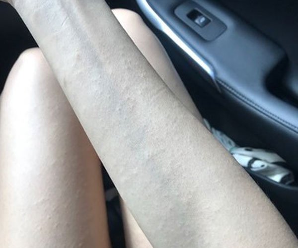 �����ɹ����ݡ����ͼƬ ��ôȥӦ�Ժ�����