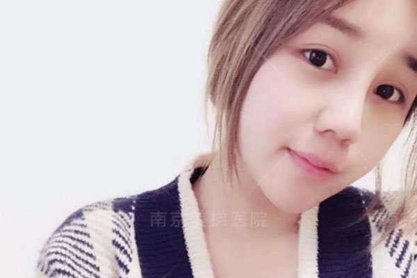 120瘦到90斤脸有什么变化 面部是真的没有什么精神