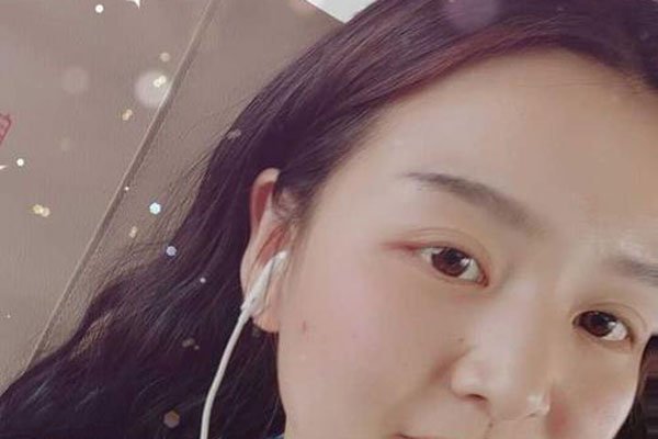120瘦到90斤脸有什么变化 面部是真的没有什么精神