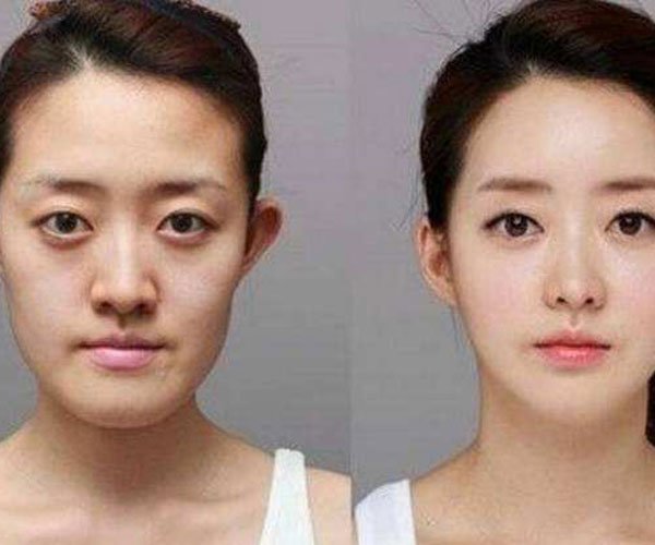 冯建老婆真的整容了吗 离婚只因老婆以前长的丑