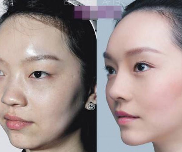 冯建老婆真的整容了吗 离婚只因老婆以前长的丑