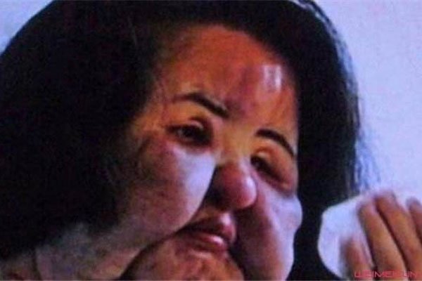 韩苗可原来的样子 因为注射食用油整容成僵硬脸