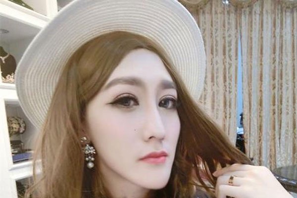 韩苗可原来的样子 因为注射食用油整容成僵硬脸