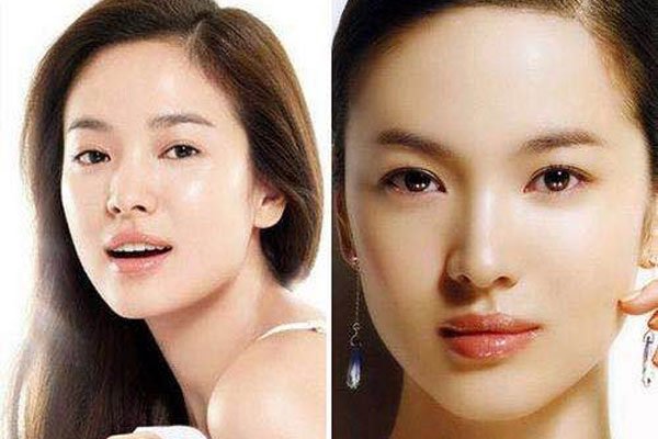 宋慧乔双眼皮是什么类型 能呈现出自然的双眼皮形态