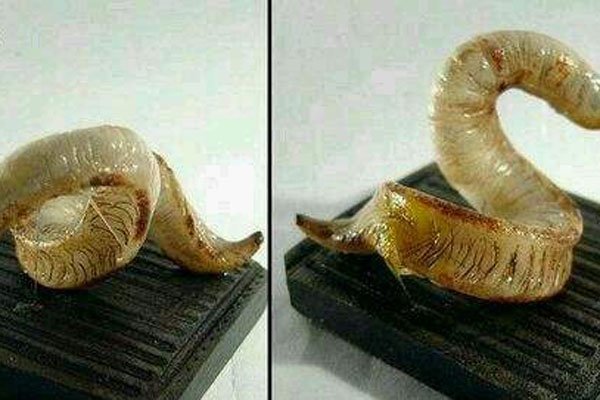 尸虫是什么样子的+病人身上图片 美味小龙虾是二战尸虫吗