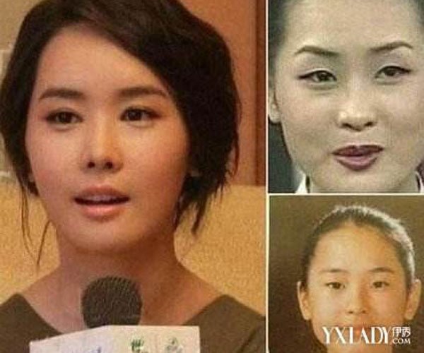 刘仁娜整容前后对比照 变一张令很多人羡慕的容颜